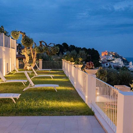 Casaragno Villa Vieste Exterior foto